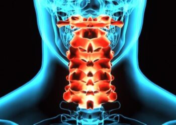 SCI person`s initial response to CIC? (Title11)